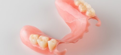 針金のない入れ歯